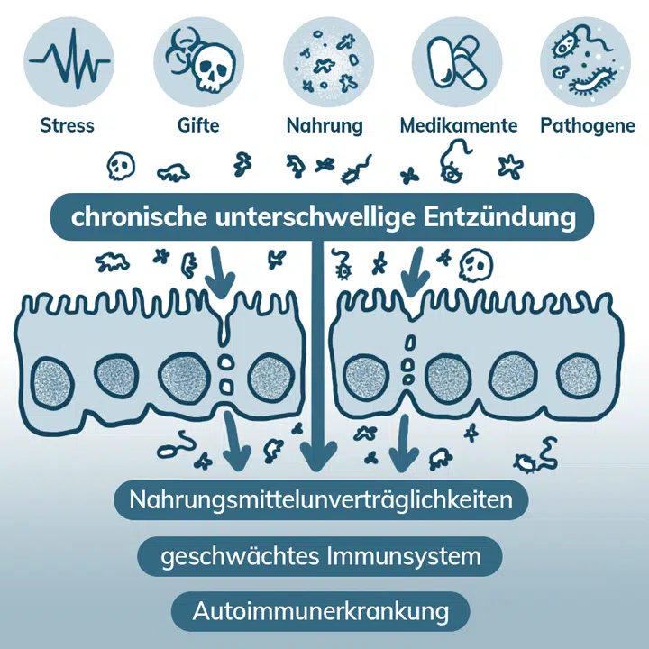 Auslöser des Leaky-Gut-Syndroms können Stress, Gifte, Nahrung, Medikamente und Pathogene sein.