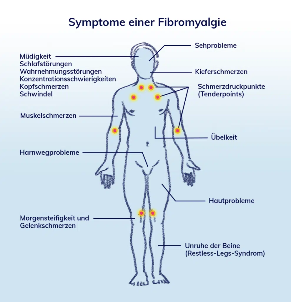 Übersichts-Skizze zu Symptome einer Fibromyalgie von Heilpraktiker Markus Breitenberger aus München