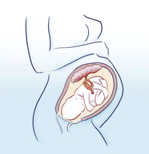Skizze von Baby in Mutterbauch